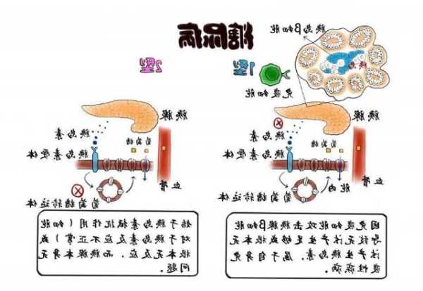 四氧嘧啶，四氧嘧啶引起糖尿病机制！